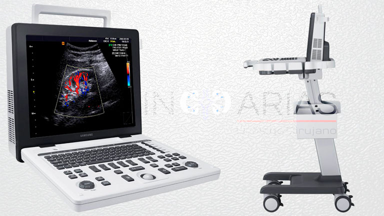 ultrasonido_doppler_3d_urologo_los_teques_martin_arias